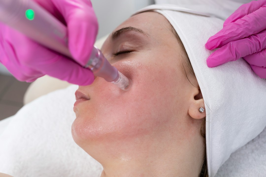 microneedling aftercare safety and microneedling aftercare safety